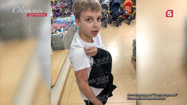 20-летний брат жены Романа Жукова расцарапал сына музыканта