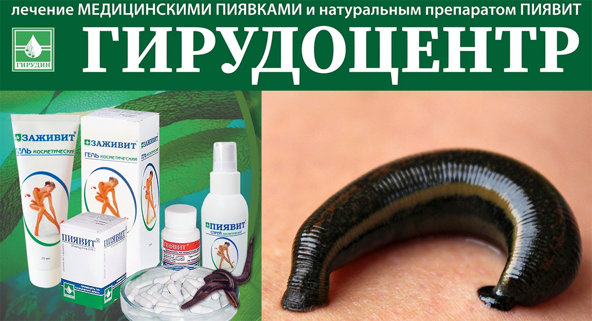 Лечение бесплодия пиявками от компании Курортная Клиника в городе Кисловодск